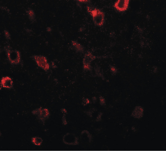 CIITA Antibody - Immunofluorescence of CIITA in human brain tissue with CIITA antibody at 20 ug/ml.
