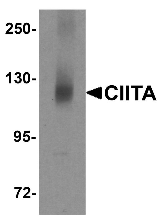 CIITA Antibody - Western blot analysis of CIITA in mouse brain tissue lysate with CIITA antibody at 1 ug/ml.