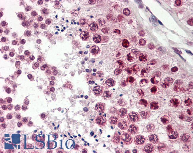 CIRP / CIRBP Antibody - Anti-CIRP / CIRBP antibody IHC of human testis. Immunohistochemistry of formalin-fixed, paraffin-embedded tissue after heat-induced antigen retrieval. Antibody dilution 3.75 ug/ml.