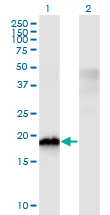 CIRP / CIRBP Antibody - Western Blot analysis of CIRBP expression in transfected 293T cell line by CIRBP monoclonal antibody (M03), clone 1C9.Lane 1: CIRBP transfected lysate (Predicted MW: 18.6 KDa).Lane 2: Non-transfected lysate.