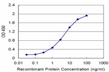 CIRP / CIRBP Antibody - Detection limit for recombinant GST tagged CIRBP is approximately 0.3 ng/ml as a capture antibody.