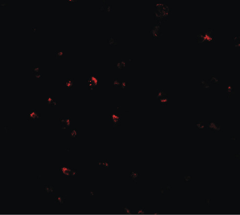 CITED2 Antibody - Immunofluorescence of CITED2 in Jurkat cells with CITED2 antibody at 20 ug/ml.