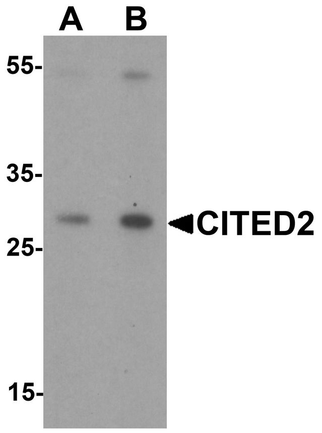 CITED2 Antibody - Western blot analysis of CITED2 in Jurkat cell lysate with CITED2 antibody at (A) 1 and (B) 2 ug/ml.