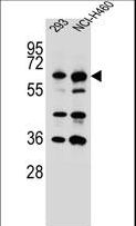 CKAP4 Antibody - CKAP4 Antibody western blot of 293,NCI-H460 cell line lysates (35 ug/lane). The CKAP4 antibody detected the CKAP4 protein (arrow).