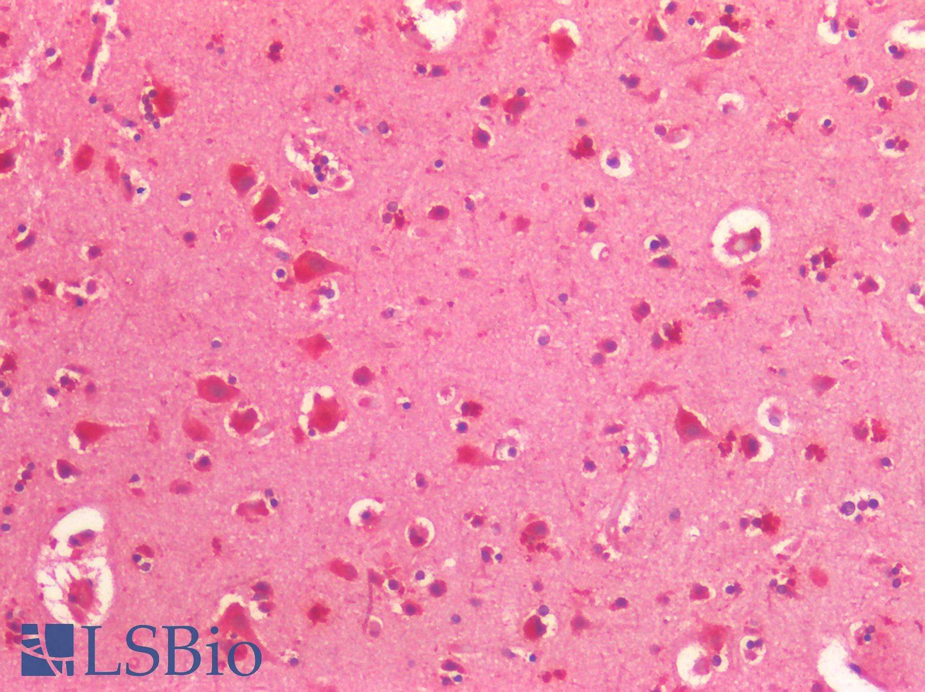 CKAP5 / ch-TOG Antibody - Human Brain, Cortex: Formalin-Fixed, Paraffin-Embedded (FFPE)