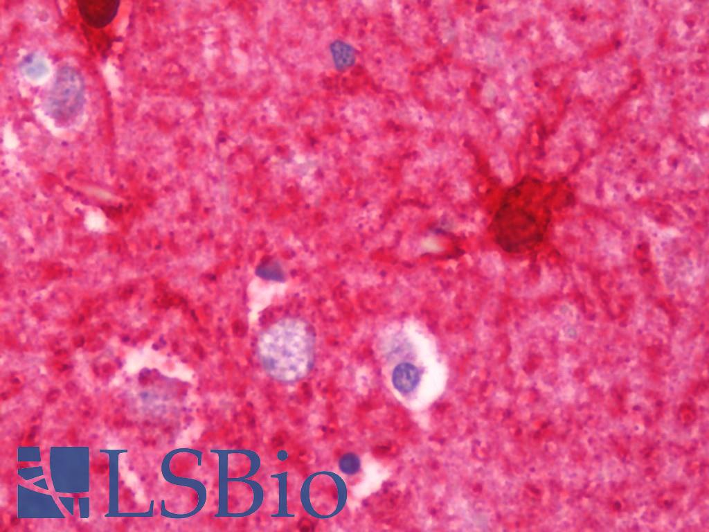 CKB / Creatine Kinase BB Antibody - Anti-CKB / Creatine Kinase BB antibody IHC staining of human brain, cortex. Immunohistochemistry of formalin-fixed, paraffin-embedded tissue after heat-induced antigen retrieval. Antibody concentration 7.5 ug/ml.
