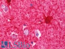 CKB / Creatine Kinase BB Antibody - Anti-CKB / Creatine Kinase BB antibody IHC staining of human brain, cortex. Immunohistochemistry of formalin-fixed, paraffin-embedded tissue after heat-induced antigen retrieval. Antibody concentration 7.5 ug/ml.