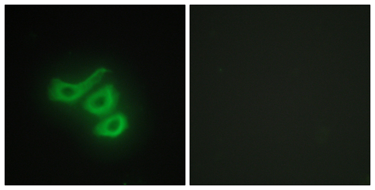 CKM / Creatine Kinase MM Antibody - Immunofluorescence analysis of HepG2 cells, using M-CK Antibody. The picture on the right is blocked with the synthesized peptide.