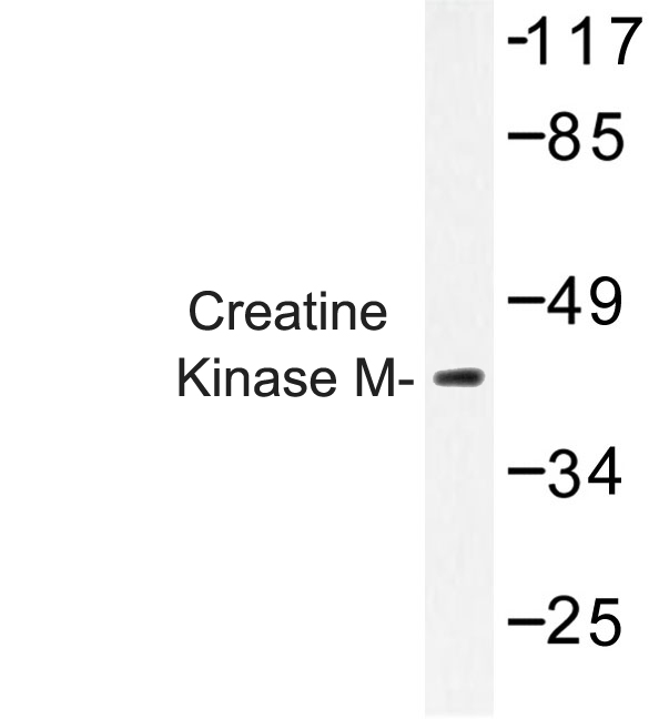 CKM / Creatine Kinase MM Antibody - Western blot analysis of Creatine Kinase M (Y14) antibody in extracts from Jurkat cells.