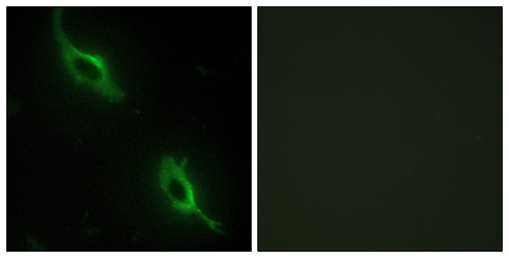 CKMT2 Antibody - Immunofluorescence analysis of NIH/3T3 cells, using CKMT2 Antibody. The picture on the right is blocked with the synthesized peptide.