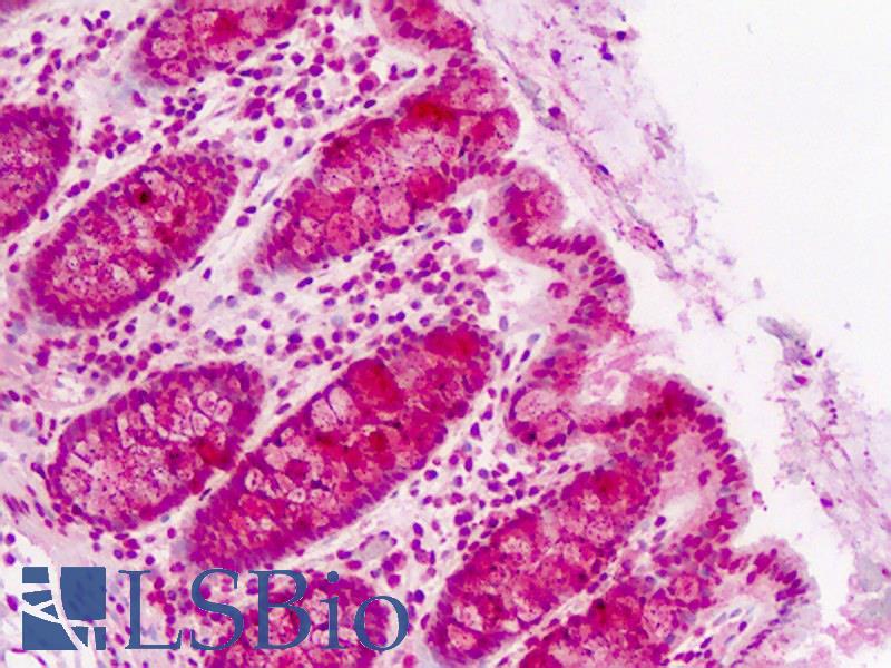 CLASP2 Antibody - Human Colon: Formalin-Fixed, Paraffin-Embedded (FFPE)