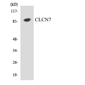 CLC-7 / CLCN7 Antibody - Western blot analysis of the lysates from COLO205 cells using CLCN7 antibody.