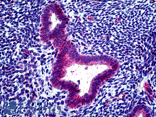 CLCN2 Antibody - Anti-CLCN2 antibody IHC of human uterus. Immunohistochemistry of formalin-fixed, paraffin-embedded tissue after heat-induced antigen retrieval. Antibody concentration 3.75 ug/ml.