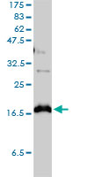 CLDN1 / Claudin 1 Antibody - CLDN1 monoclonal antibody, clone 1C5-D9. Western blot of CLDN1 expression in PRC/PRF/5.