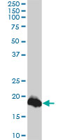 CLDN1 / Claudin 1 Antibody - CLDN1 monoclonal antibody, clone 1C5-D9. Western blot of CLDN1 expression in A-431.