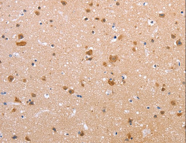 CLDN10 / Claudin 10 Antibody - Immunohistochemistry of paraffin-embedded Human brain using CLDN10 Polyclonal Antibody at dilution of 1:50.