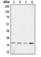 CLDN11 / Claudin 11 Antibody - Western blot analysis of Claudin 11 expression in HeLa (A); Raw264.7 (B); mouse brain (C); rat heart (D) whole cell lysates.