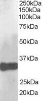 CLDN14 / Claudin 14 Antibody - (1 ug/ml) Staining of Human Liver lysate (35 ug protein in RIPA buffer). Primary incubation was 1 hour. Detected by chemiluminescence.