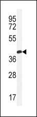 CLDN16 / Claudin 16 Antibody - CLDN16 Antibody western blot of MDA-MB435 cell line lysates (35 ug/lane). The CLDN16 antibody detected the CLDN16 protein (arrow).