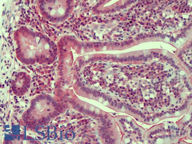 CLDN2 / Claudin 2 Antibody - Anti-CLDN2 / Claudin 2 antibody IHC of human small intestine. Immunohistochemistry of formalin-fixed, paraffin-embedded tissue after heat-induced antigen retrieval. Antibody concentration 5 ug/ml.