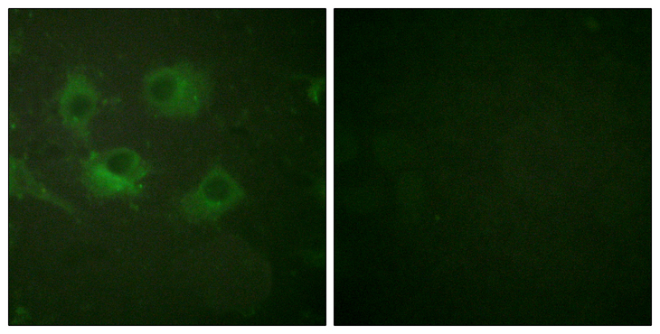CLDN3 / Claudin 3 Antibody - Immunofluorescence analysis of HUVEC cells, using Claudin 3 Antibody. The picture on the right is blocked with the synthesized peptide.