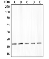 CLDN4 / Claudin 4 Antibody - Western blot analysis of Claudin 4 expression in DLD (A); SW480 (B); LS1034 (C); MIA (D); PaCa2 (E) whole cell lysates.