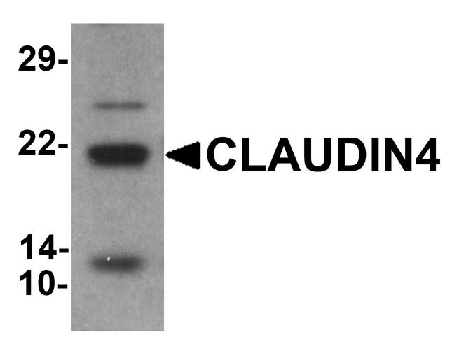 CLDN4 / Claudin 4 Antibody - Western blot analysis of CLAUDIN4 in human colon tissue lysate with CLAUDIN4 antibody at 1 ug/ml