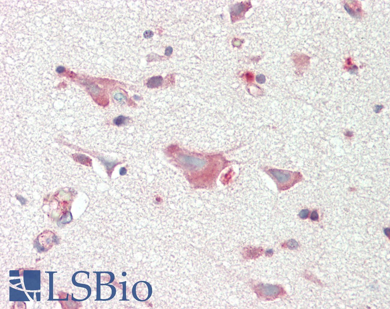 CLDN5 / Claudin 5 Antibody - Anti-CLDN5 / Claudin 5 antibody IHC staining of human brain, cortex. Immunohistochemistry of formalin-fixed, paraffin-embedded tissue after heat-induced antigen retrieval. Antibody dilution 1:200.