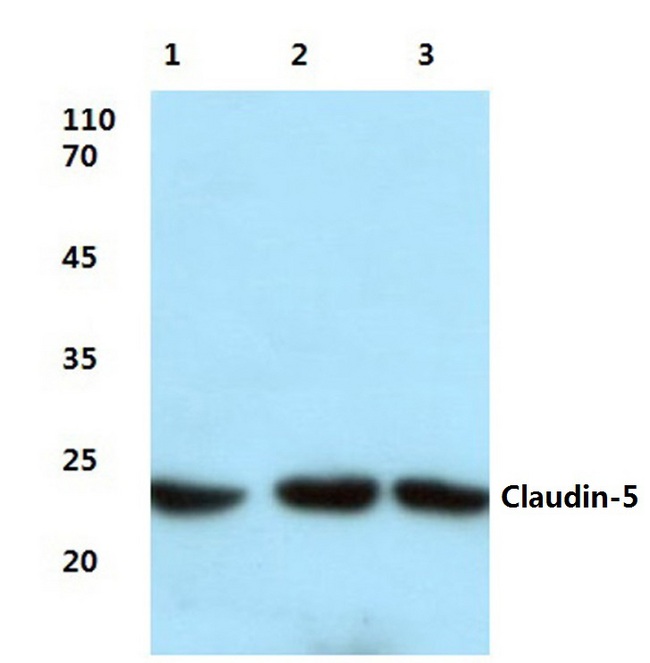 CLDN5 / Claudin 5 Antibody - Western blot of Claudin 5 (S201) pAb at a 1:500 dilution. Lane 1: HeLa cell lysate treated with LPS. Lane 2: Mouse liver tissue lysate. Lane 3: Rat lung tissue lysate.