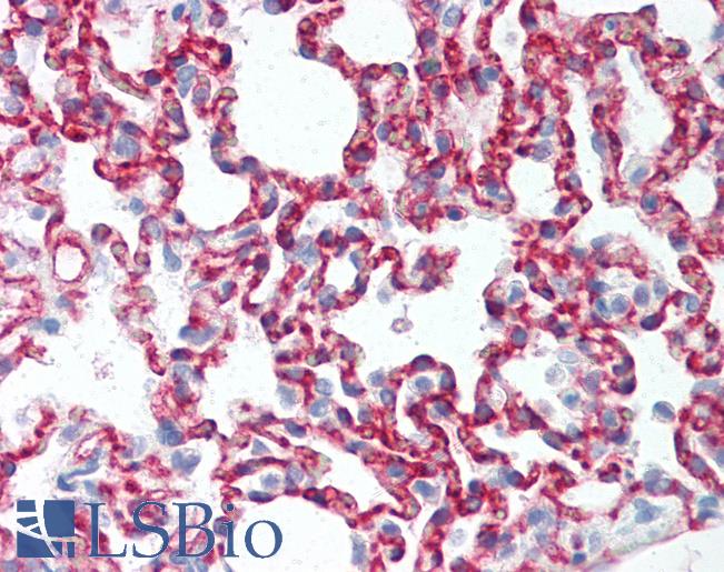 CLDN5 / Claudin 5 Antibody - Anti-CLDN5 / Claudin 5 antibody IHC of rat lung. Immunohistochemistry of formalin-fixed, paraffin-embedded tissue after heat-induced antigen retrieval. Antibody concentration 10 ug/ml.