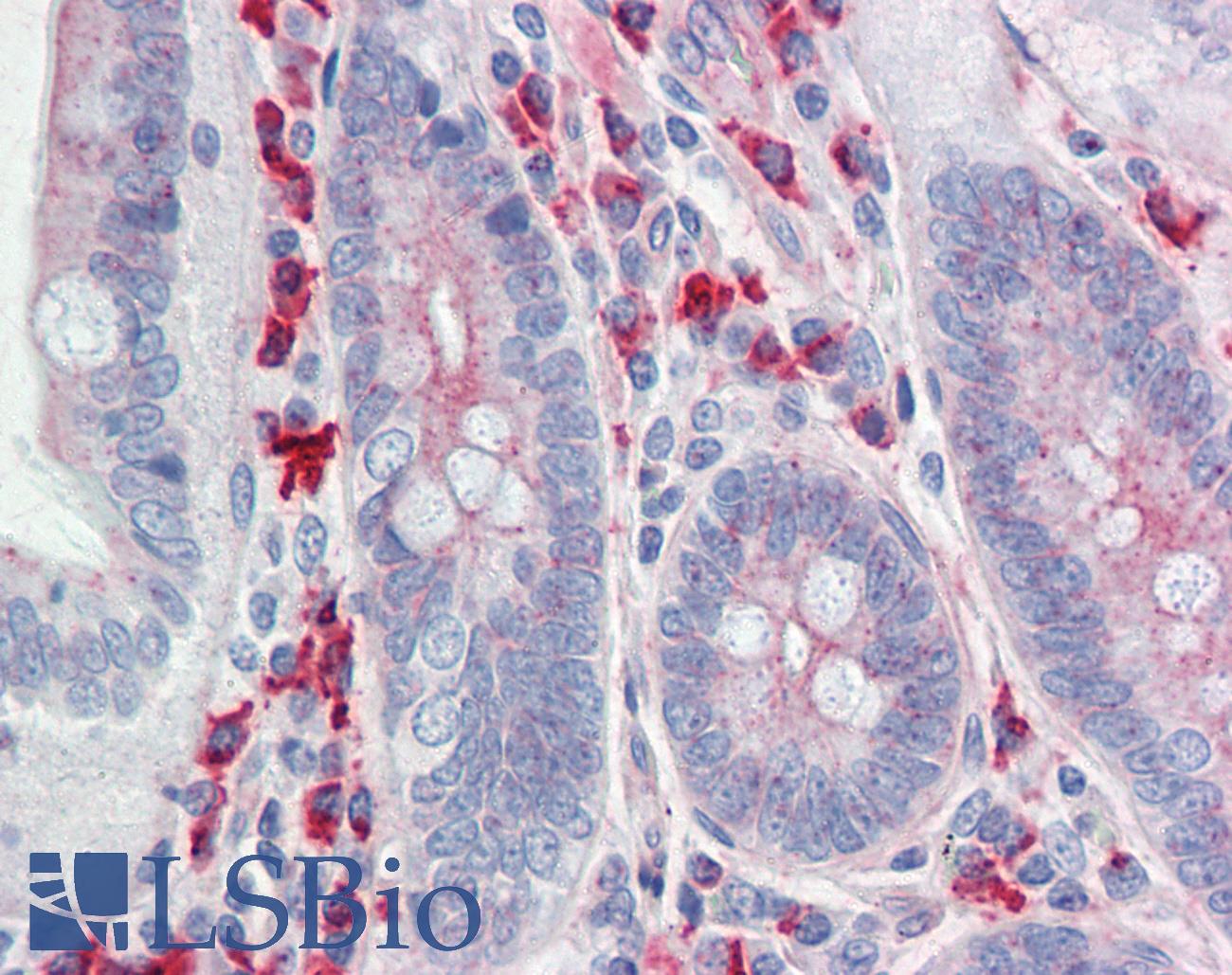 CLDN6 / Claudin 6 Antibody - Anti-CLDN6 / Claudin 6 antibody IHC staining of human small intestine. Immunohistochemistry of formalin-fixed, paraffin-embedded tissue after heat-induced antigen retrieval.