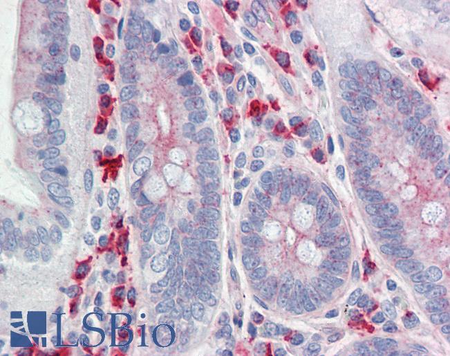 CLDN6 / Claudin 6 Antibody - Anti-CLDN6 / Claudin 6 antibody IHC staining of human small intestine. Immunohistochemistry of formalin-fixed, paraffin-embedded tissue after heat-induced antigen retrieval.
