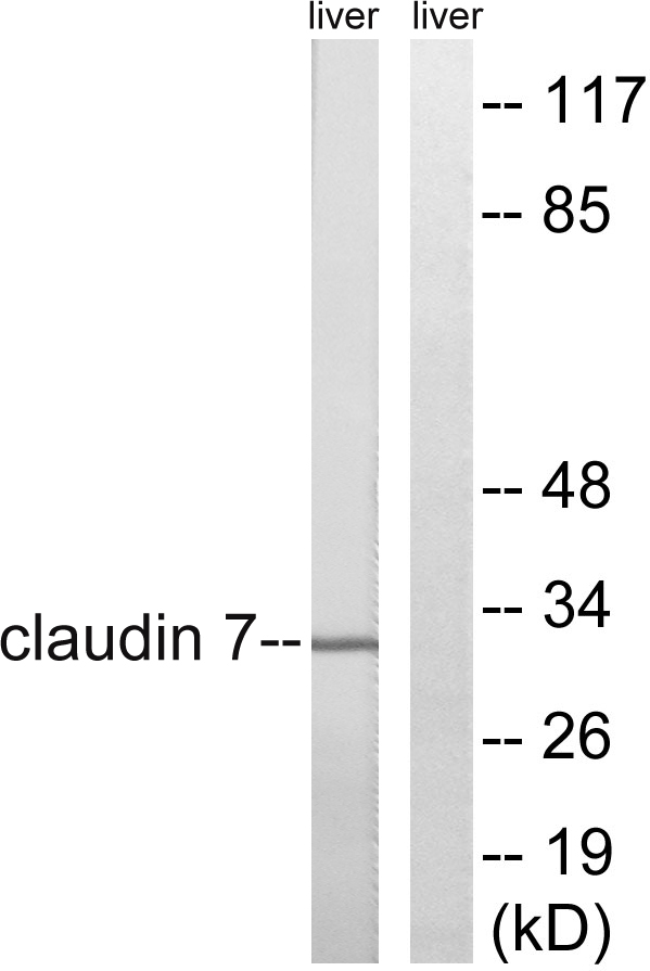 CLDN7 / Claudin 7 Antibody - Western blot analysis of lysates from rat liver cells, using Claudin 7 Antibody. The lane on the right is blocked with the synthesized peptide.