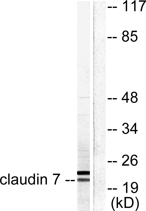 CLDN7 / Claudin 7 Antibody - Western blot analysis of lysates from 293 cells, using Claudin 7 Antibody. The lane on the right is blocked with the synthesized peptide.