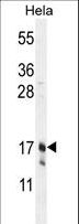 CLDN7 / Claudin 7 Antibody - CLDN7 Antibody western blot of HeLa cell line lysates (35 ug/lane). The CLDN7 antibody detected the CLDN7 protein (arrow).