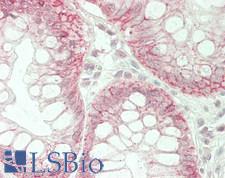 CLDN7 / Claudin 7 Antibody - Human Colon: Formalin-Fixed, Paraffin-Embedded (FFPE)