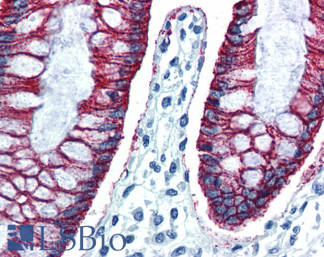 CLDN7 / Claudin 7 Antibody - Anti-CLDN7 / Claudin-7 antibody IHC of human colon. Immunohistochemistry of formalin-fixed, paraffin-embedded tissue after heat-induced antigen retrieval. Antibody concentration 10 ug/ml.