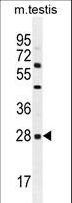 CLEC12B Antibody - CLEC12B Antibody western blot of mouse testis tissue lysates (35 ug/lane). The CLEC12B antibody detected the CLEC12B protein (arrow).