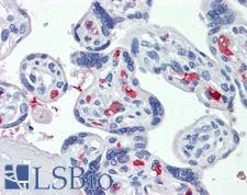 CLEC2D / OCIL / LLT1 Antibody - Anti-CLEC2D antibody IHC of human placenta. Immunohistochemistry of formalin-fixed, paraffin-embedded tissue after heat-induced antigen retrieval. Antibody concentration 3.75 ug/ml.