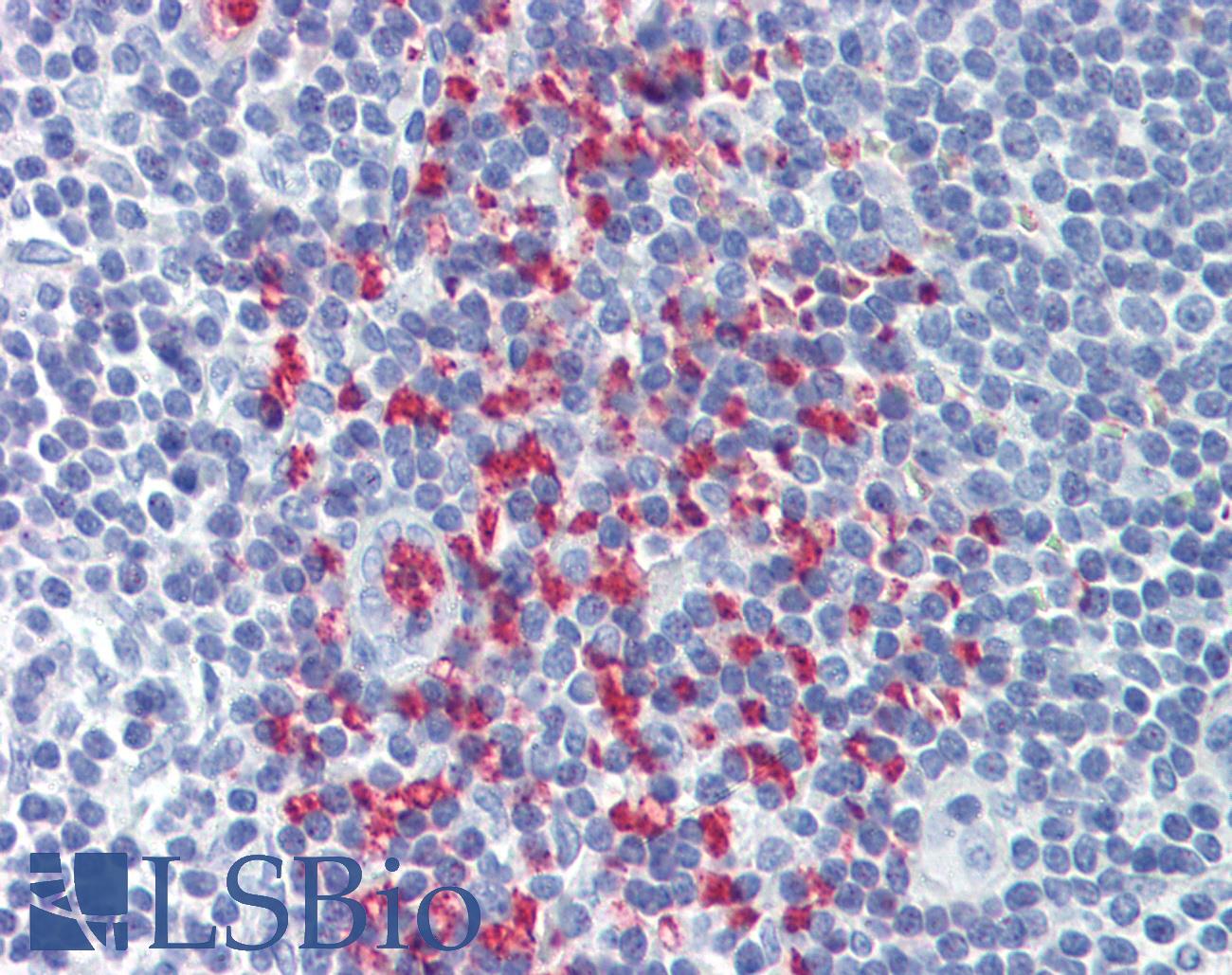 CLEC2D / OCIL / LLT1 Antibody - Anti-CLEC2D antibody IHC of human tonsil. Immunohistochemistry of formalin-fixed, paraffin-embedded tissue after heat-induced antigen retrieval. Antibody concentration 3.75 ug/ml.