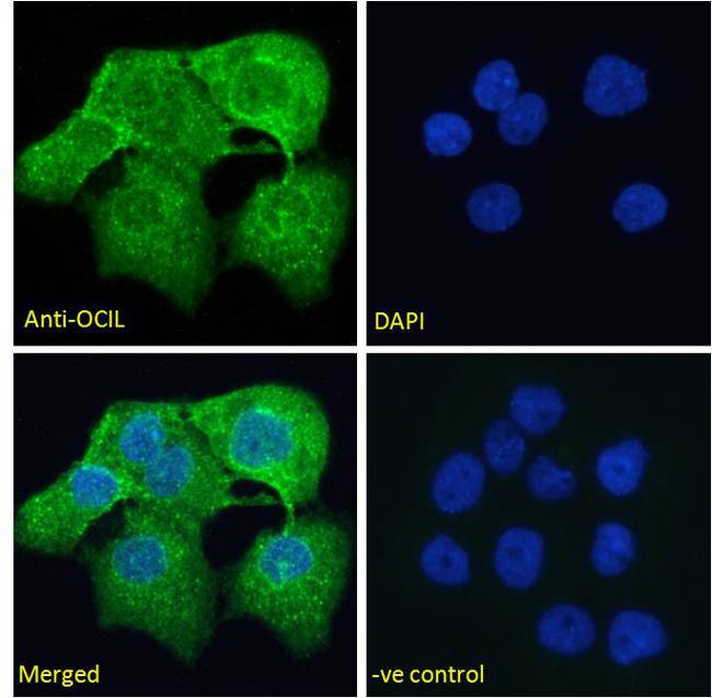 CLEC2D / OCIL / LLT1 Antibody - CLEC2D / OCIL / LLT1 antibody immunofluorescence analysis of paraformaldehyde fixed A431 cells, permeabilized with 0.15% Triton. Primary incubation 1hr (10ug/ml) followed by Alexa Fluor 488 secondary antibody (2ug/ml), showing cytoplasmic/membrane staining. The nuclear stain is DAPI (blue). Negative control: Unimmunized goat IgG (10ug/ml) followed by Alexa Fluor 488 secondary antibody (2ug/ml).