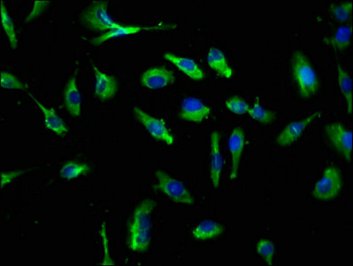 CLEC4E / MINCLE Antibody - Immunofluorescence staining of U251 cells with CLEC4E Antibody at 1:250, counter-stained with DAPI. The cells were fixed in 4% formaldehyde, permeabilized using 0.2% Triton X-100 and blocked in 10% normal Goat Serum. The cells were then incubated with the antibody overnight at 4°C. The secondary antibody was Alexa Fluor 488-congugated AffiniPure Goat Anti-Rabbit IgG(H+L).