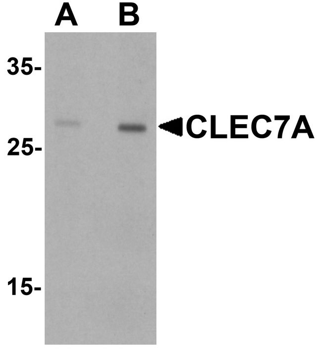 CLEC7A / Dectin 1 Antibody - Western blot analysis of CLEC7A in rat spleen tissue lysate with CLEC7A antibody at (A) 1 and (B) 2 ug/.
