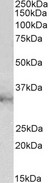 CLIC1 / NCC27 Antibody - CLIC1 antibody EB12398 (2 ug/ml) staining of U937 lysate (35 ug protein in RIPA buffer). Primary incubation was 1 hour. Detected by chemiluminescence.