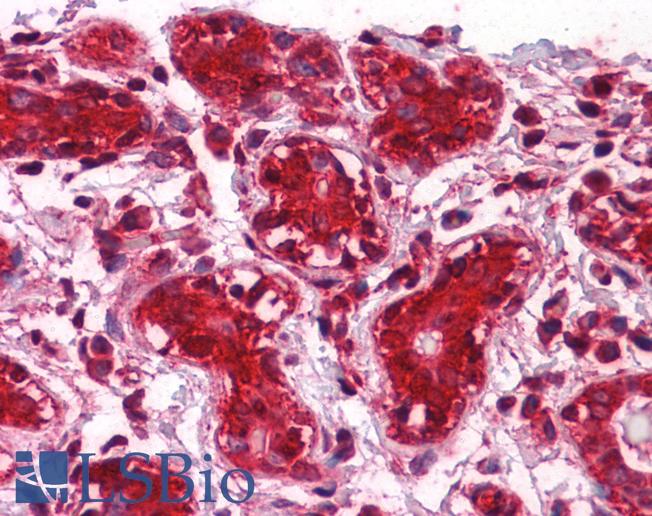 CLIC1 / NCC27 Antibody - Anti-CLIC1 antibody IHC of human breast. Immunohistochemistry of formalin-fixed, paraffin-embedded tissue after heat-induced antigen retrieval. Antibody concentration 5 ug/ml.