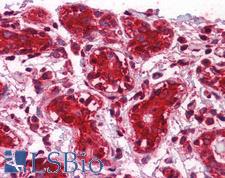 CLIC1 / NCC27 Antibody - Anti-CLIC1 antibody IHC of human breast. Immunohistochemistry of formalin-fixed, paraffin-embedded tissue after heat-induced antigen retrieval. Antibody concentration 5 ug/ml.