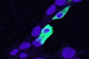 CLIC4 Antibody - Goat Anti-CLIC4 Antibody (5ug/ml) staining of min6 cells transiently expressing mouse Clic4. Nuclear counter staining by Hoechst. Data kindly provided by Dr. Virginie Nepote, Lausanne University, Switzerland.