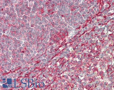 CLINT1 Antibody - Human Spleen: Formalin-Fixed, Paraffin-Embedded (FFPE)