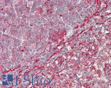 CLINT1 Antibody - Human Spleen: Formalin-Fixed, Paraffin-Embedded (FFPE)