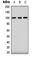 CLOCK Antibody - Western blot analysis of CLOCK expression in HeLa (A); HEK293T (B); NIH3T3 (C) whole cell lysates.